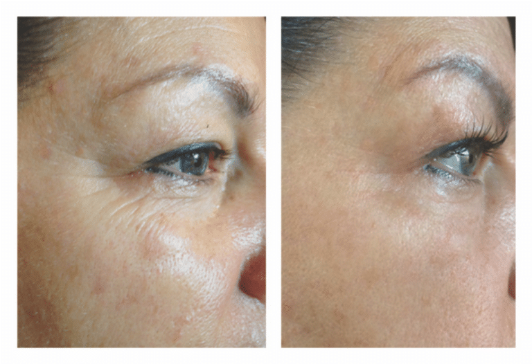 015ProcellAntiAging5YearsApart (1)