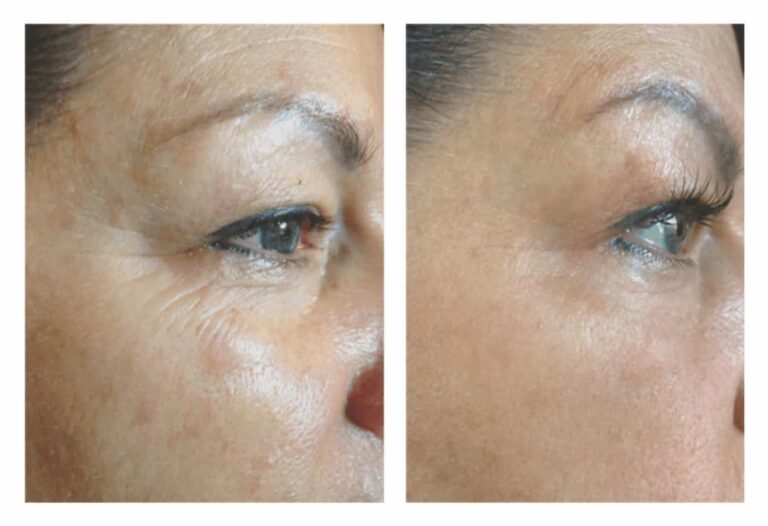 ProcellAntiAging5YearsApart_optimized