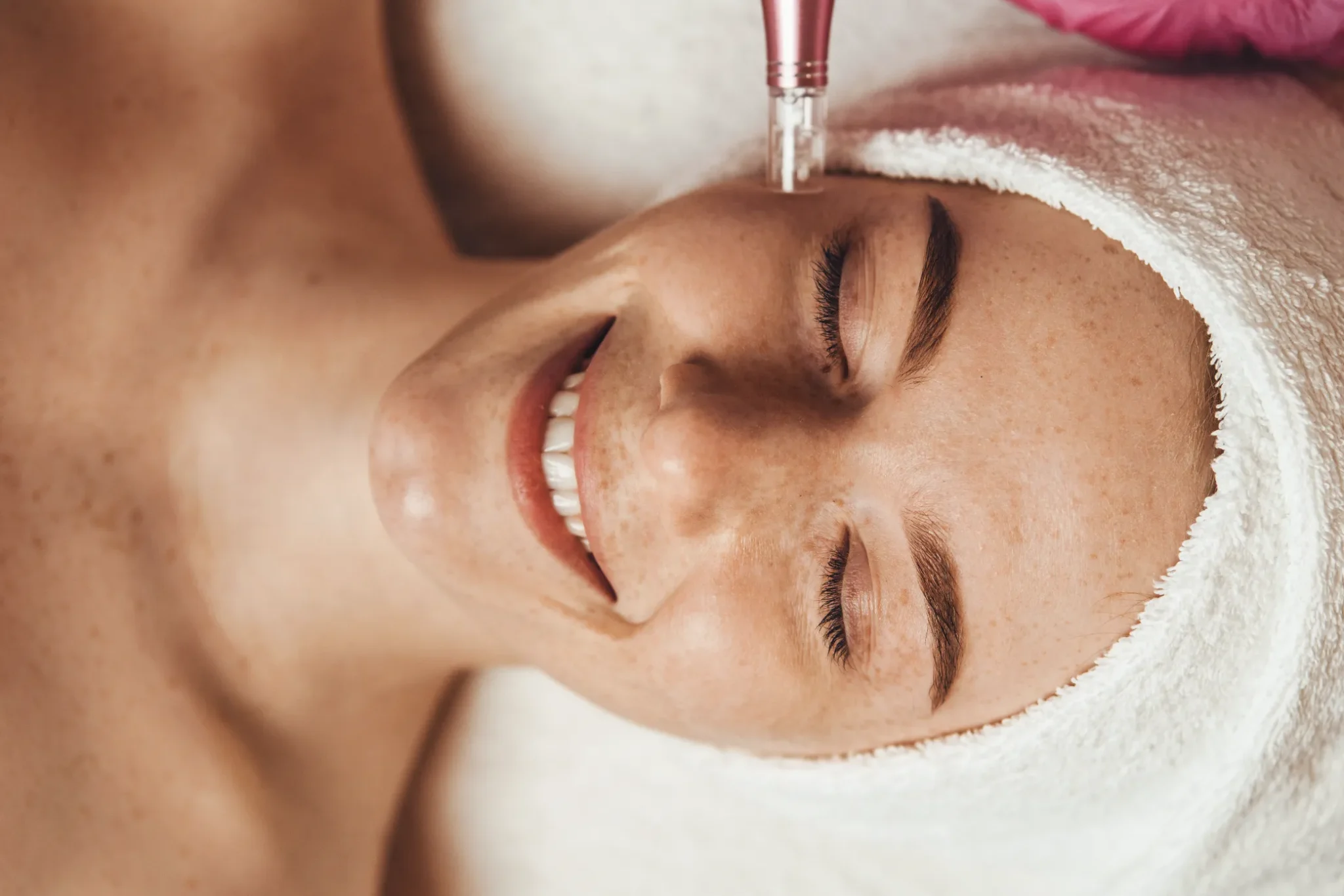 Person receiving a relaxing microneedling procedure at a Colorado Springs medical aesthetics clinic.