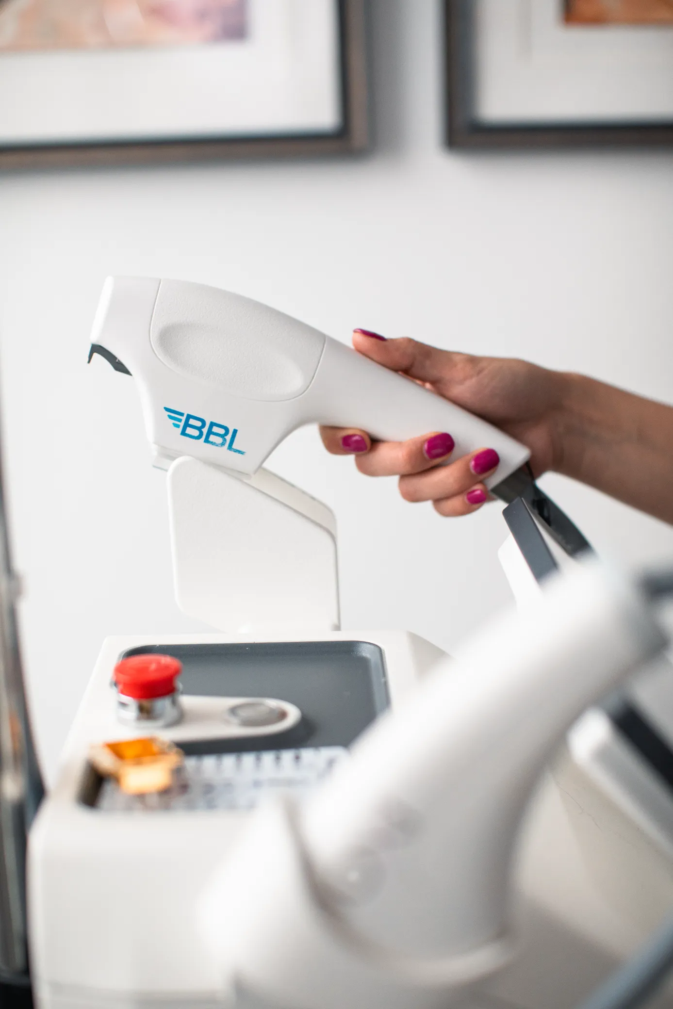 Hand holding a BBL laser device in a Colorado Springs medical aesthetics clinic.