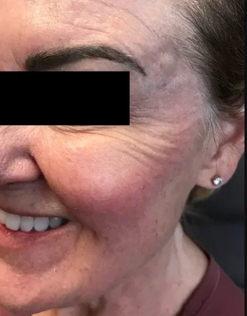 Client at Refine Aesthetics in Colorado Springs showcasing results of personalized skincare treatment.