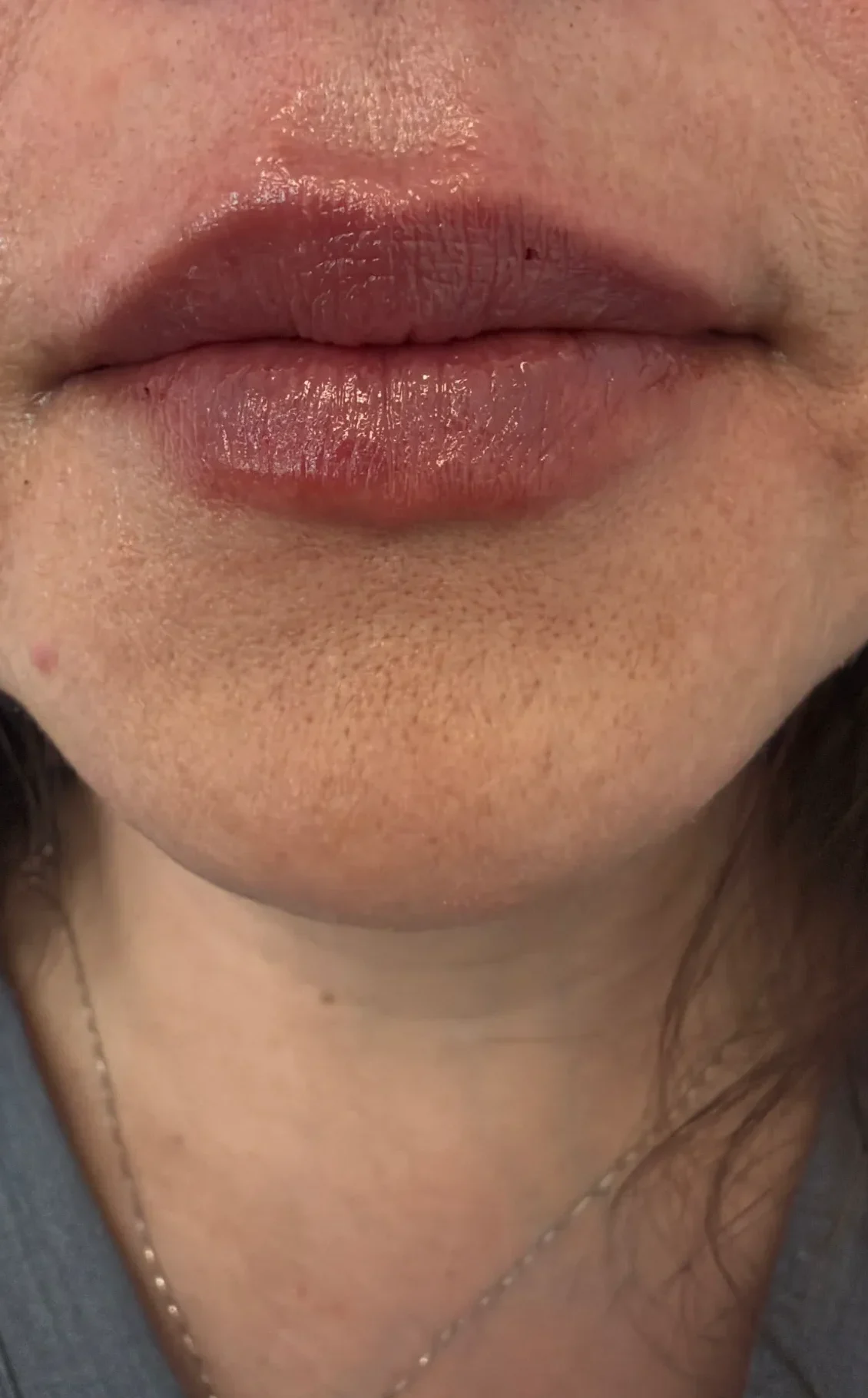 Close-up of lips showcasing natural aesthetics at a Colorado Springs medical aesthetics clinic.