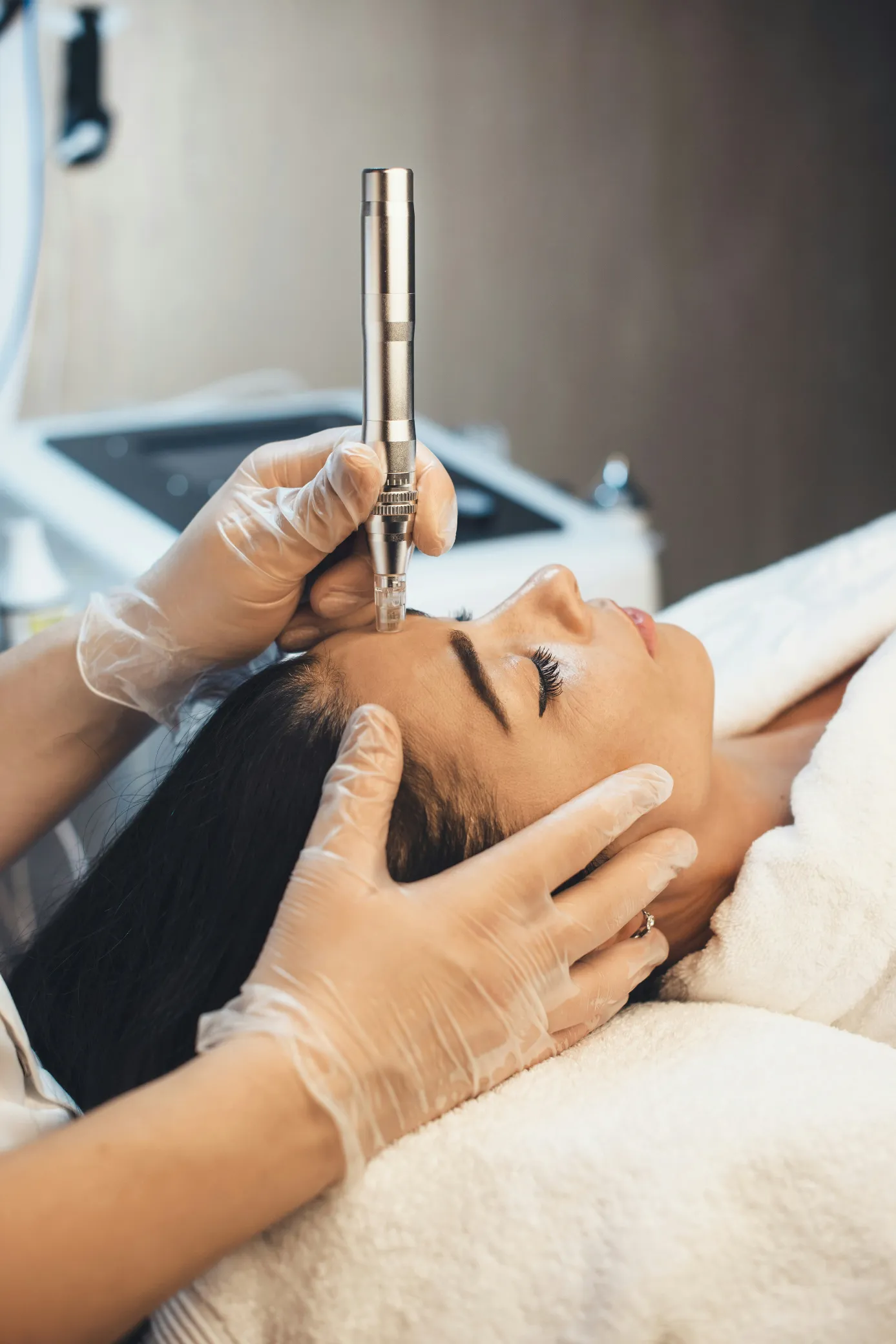 Microneedling procedure at a Colorado Springs medical aesthetics clinic for personalized skincare.
